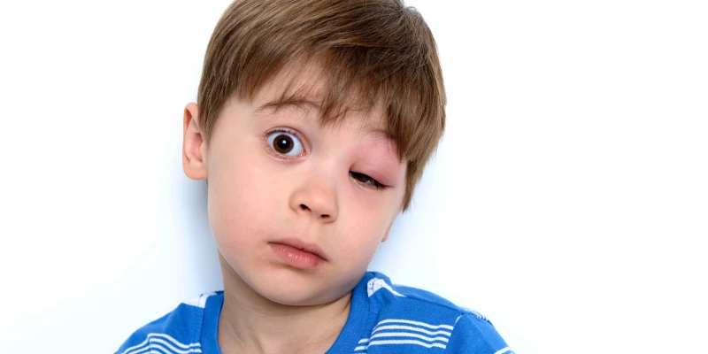 Na co se testuje alergie?